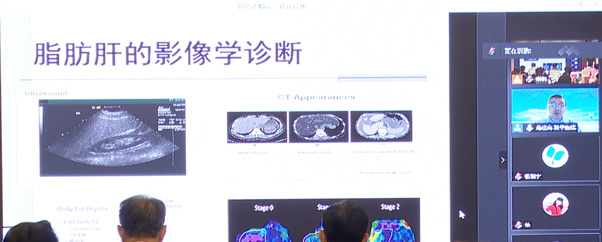 会议动态｜湖北省非酒精性脂肪性肝病学术联盟正式成立