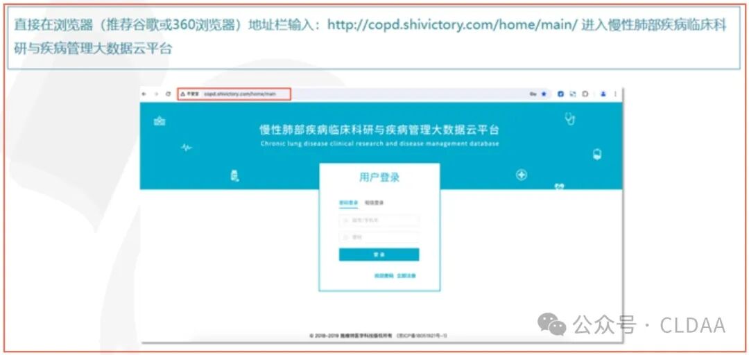通知|《中国支气管扩张症数据库》正式上线 通知|《中国支气管扩张症数据库》正式上线